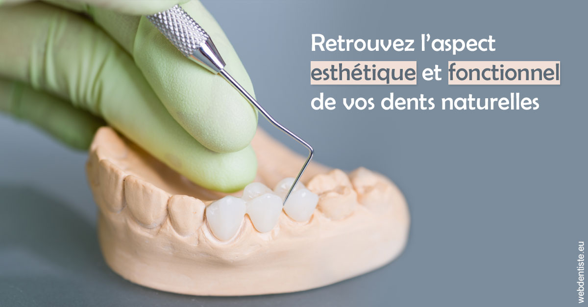 https://www.lecabinetdessourires.fr/Restaurations dentaires 1