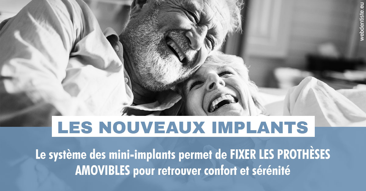 https://www.lecabinetdessourires.fr/Les nouveaux implants 2