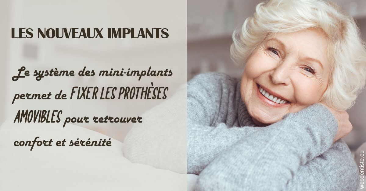 https://www.lecabinetdessourires.fr/Les nouveaux implants 1