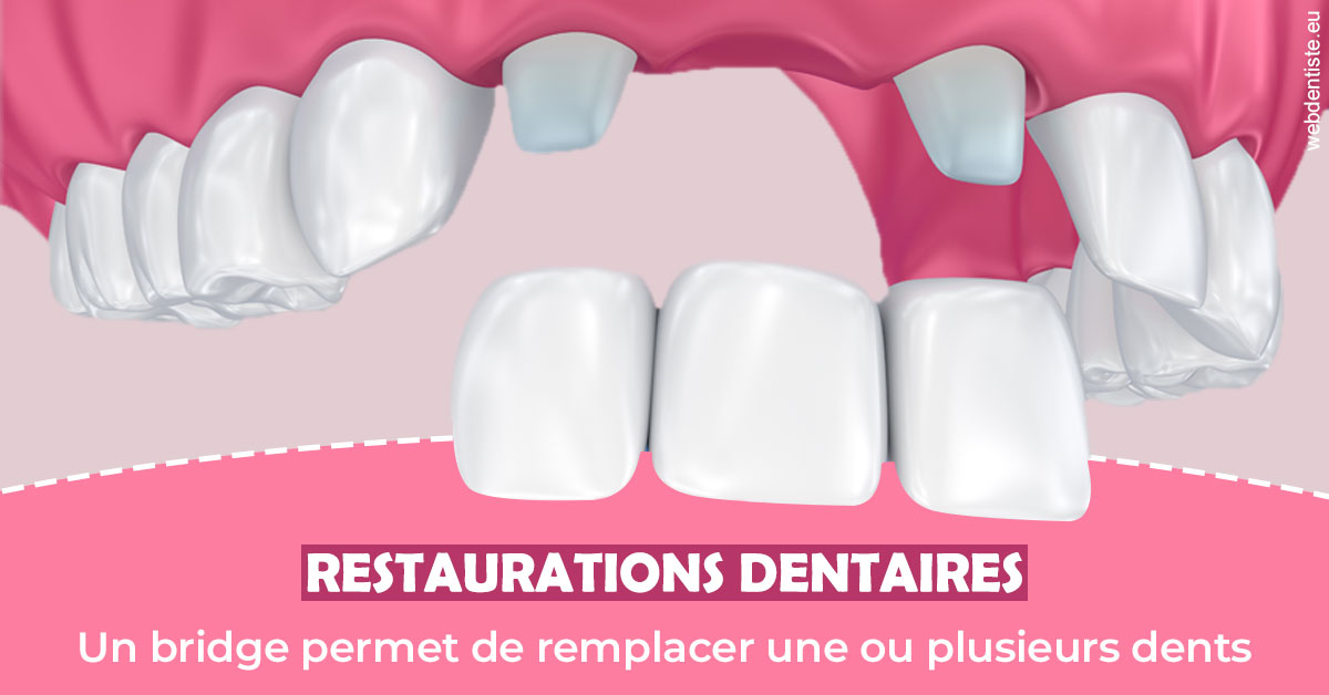 https://www.lecabinetdessourires.fr/Bridge remplacer dents 2