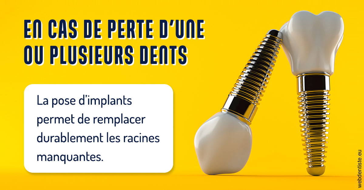 https://www.lecabinetdessourires.fr/2024 T1 - Implants 02