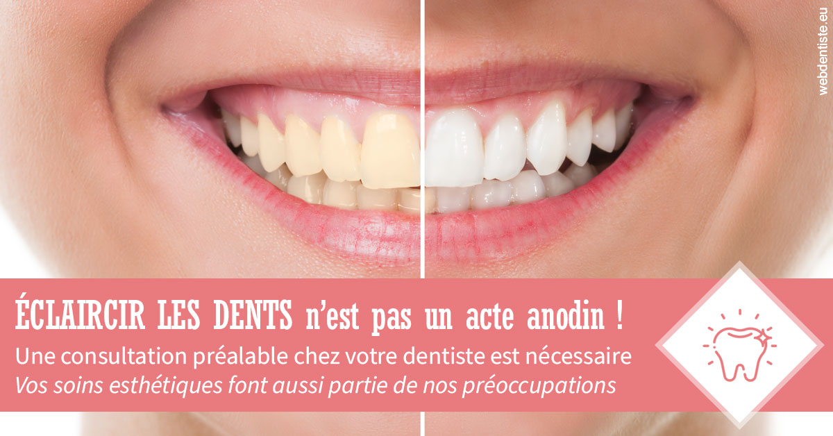 https://www.lecabinetdessourires.fr/Eclaircir les dents 1