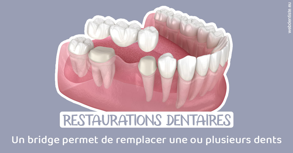 https://www.lecabinetdessourires.fr/Bridge remplacer dents 1