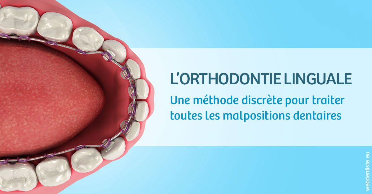 https://www.lecabinetdessourires.fr/L'orthodontie linguale 1
