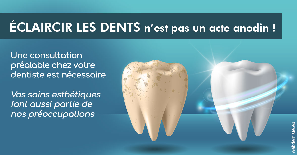 https://www.lecabinetdessourires.fr/Eclaircir les dents 2