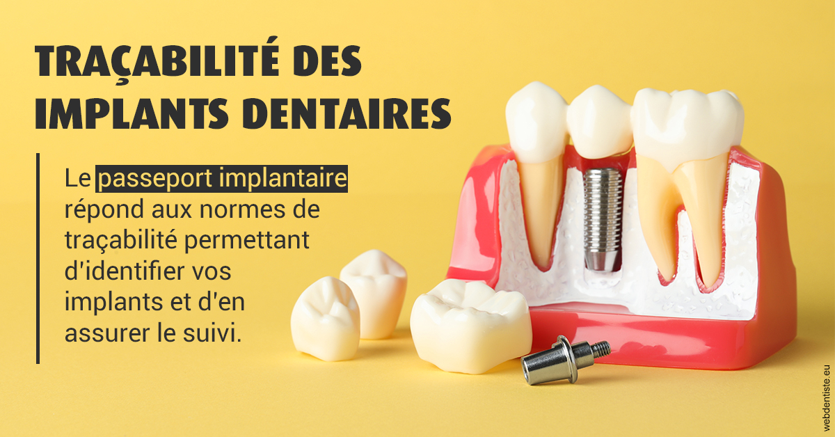 https://www.lecabinetdessourires.fr/T2 2023 - Traçabilité des implants 2