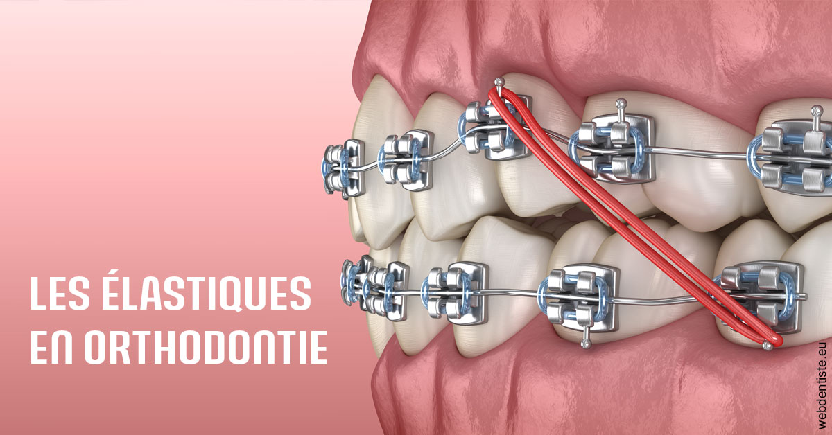 https://www.lecabinetdessourires.fr/Elastiques orthodontie 2