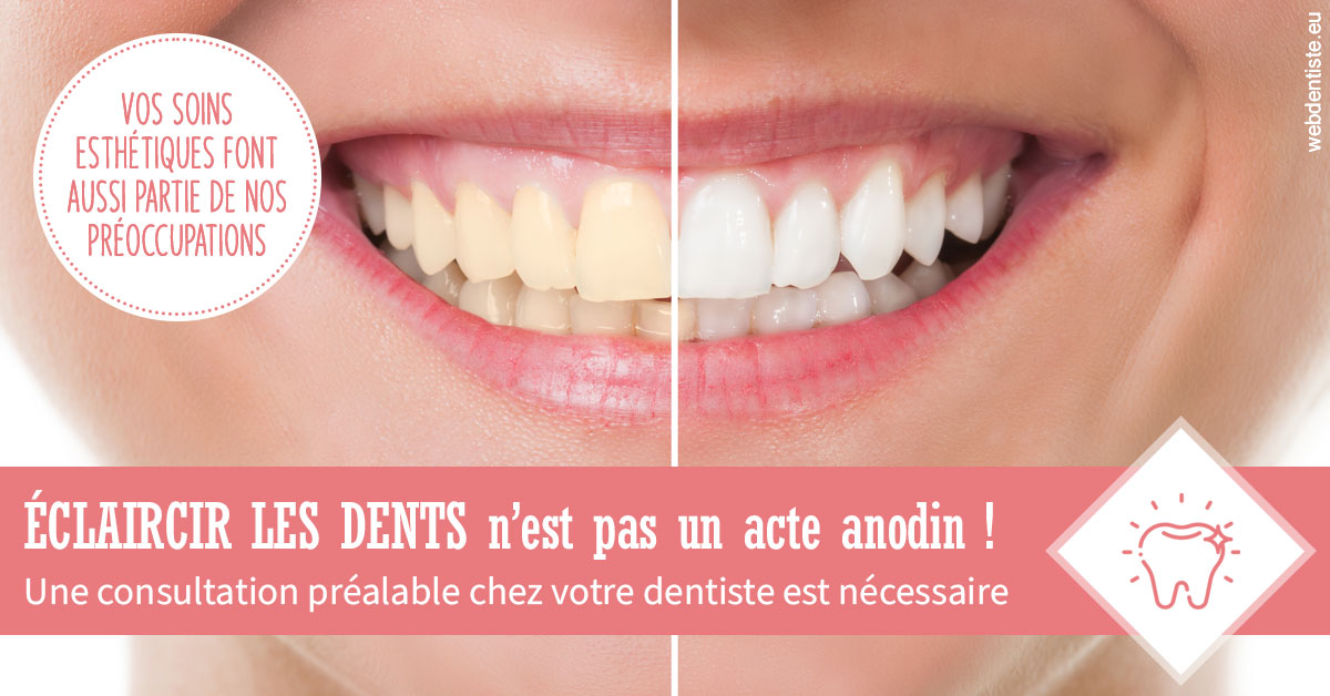 https://www.lecabinetdessourires.fr/Eclaircir les dents 1