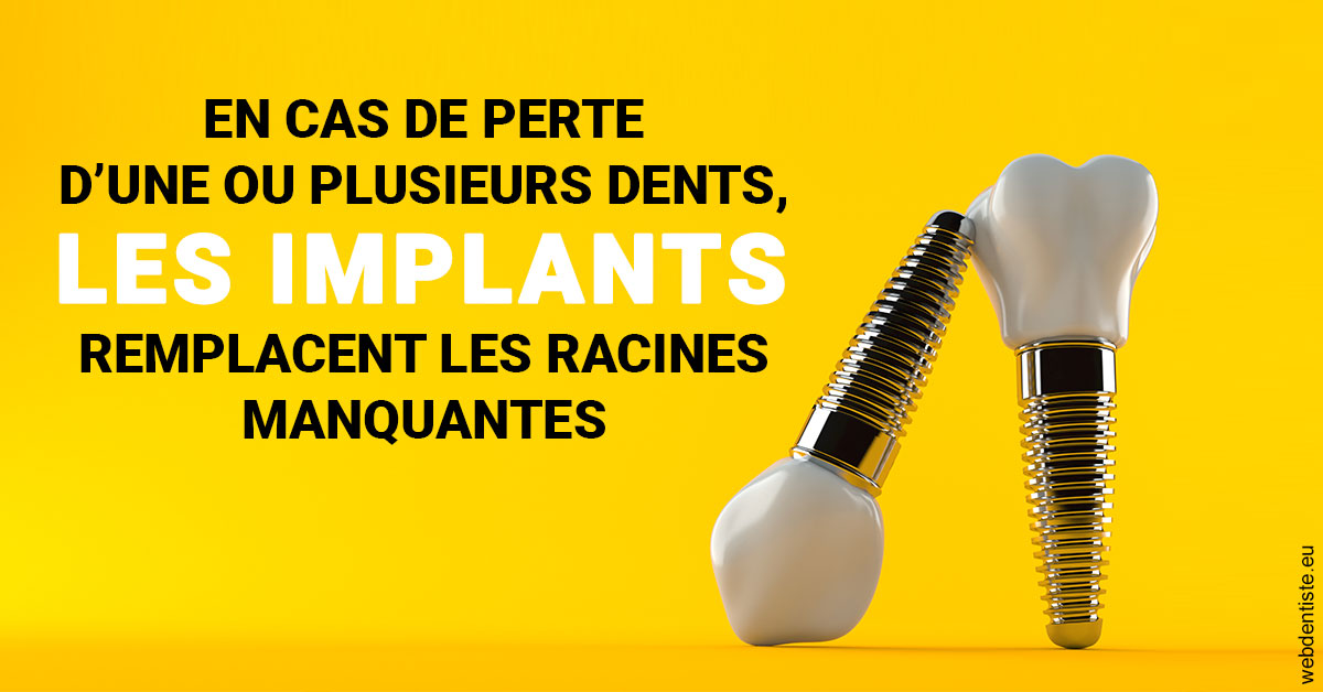 https://www.lecabinetdessourires.fr/Les implants 2