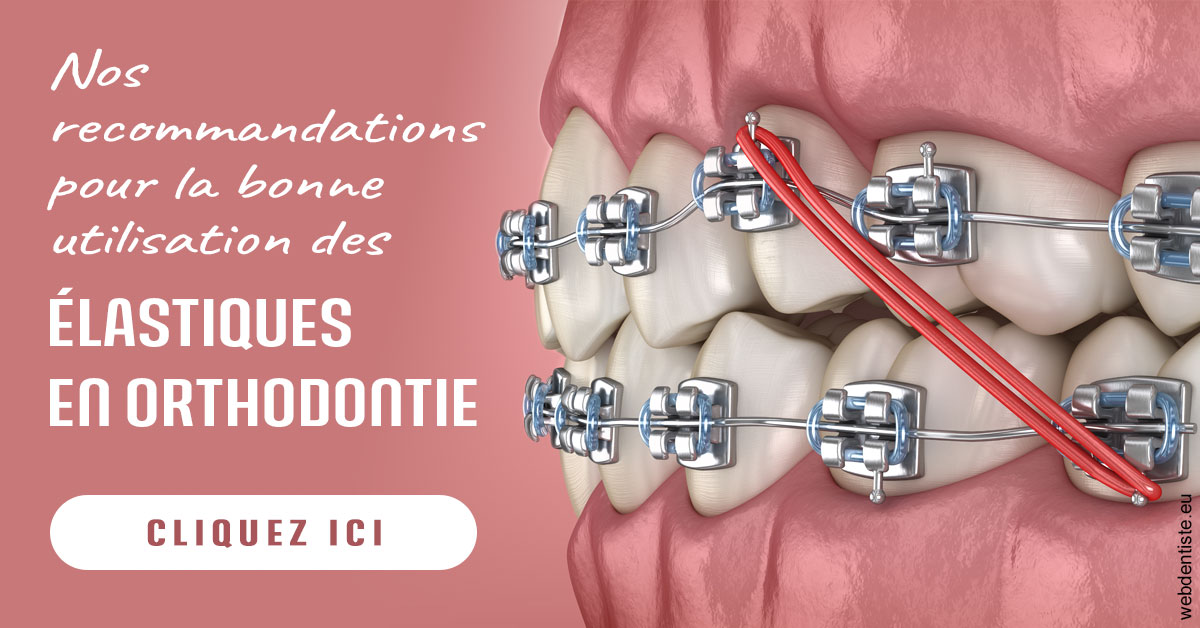 https://www.lecabinetdessourires.fr/Elastiques orthodontie 2